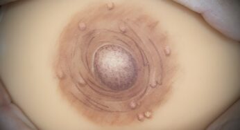 Ivonne Jimenez Ciptakan Tato Areola 3D untuk Penyintas Kanker Payudara – Solusi Sementara yang Menggugah Hati!